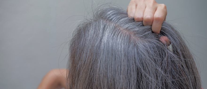 grey hair roots